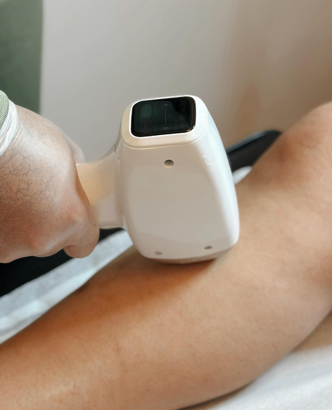 Definitieve laserontharing Gent, Oost-Vlaanderen